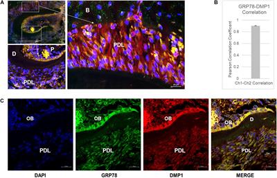 Endocytic Trafficking of DMP1 and GRP78 Complex Facilitates Osteogenic Differentiation of Human Periodontal Ligament Stem Cells